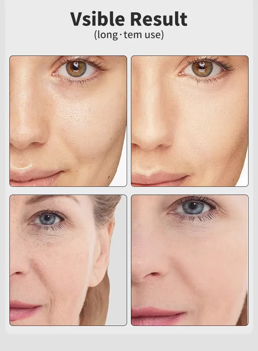 EMS Microcurrent Anti-Aging Facial Massager