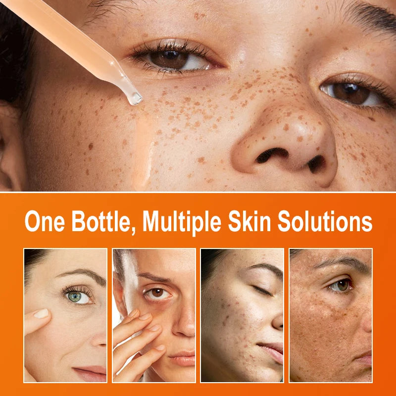 Vitamin C Facial Serum 30ml – Dark Spot Corrector, Brightening & Anti-Aging