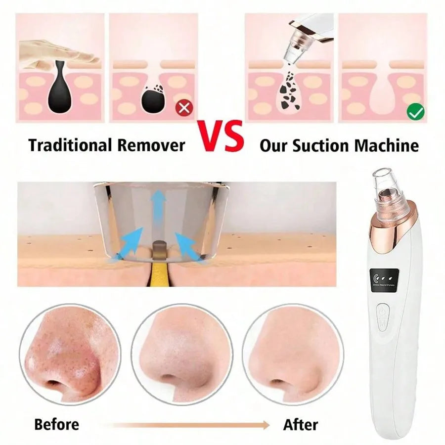 5-Level Vacuum Blackhead Remover Extractor